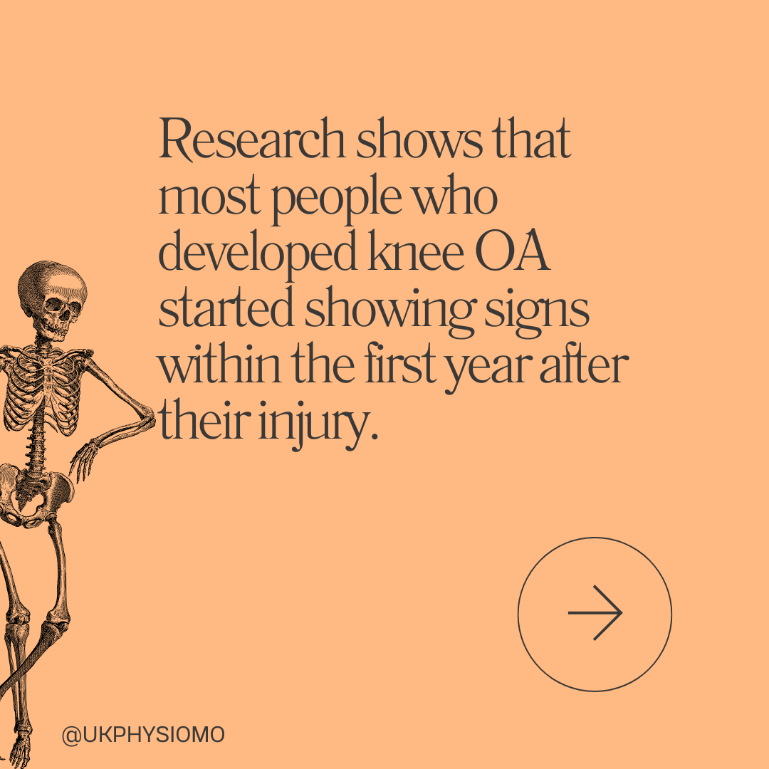 Research shows that most people who developed knee OA started showing signs within the first year after their injury